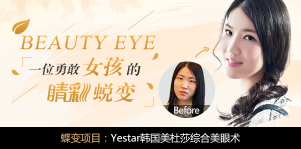 小雅美眼种草