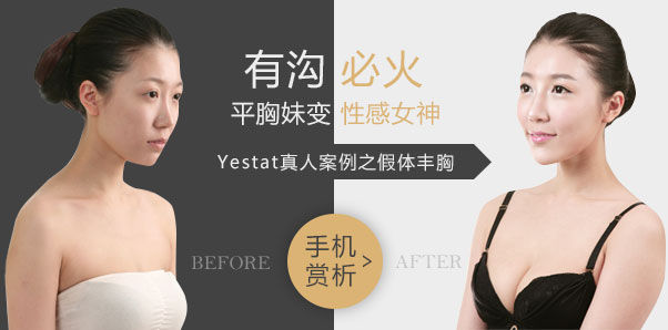 胸部种草专题