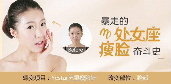 崔雅珍咬肌肥大缩小种草
