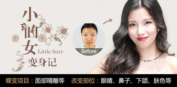杨兰微整容鼻部种草