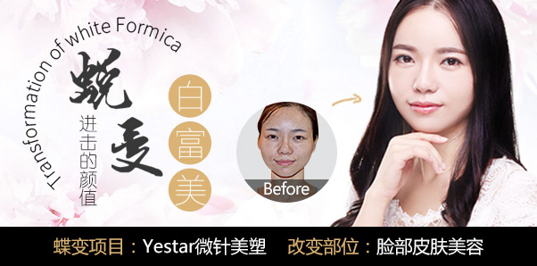 林敏皮肤美容种草