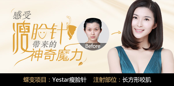 Anney咬肌肥大缩小种草
